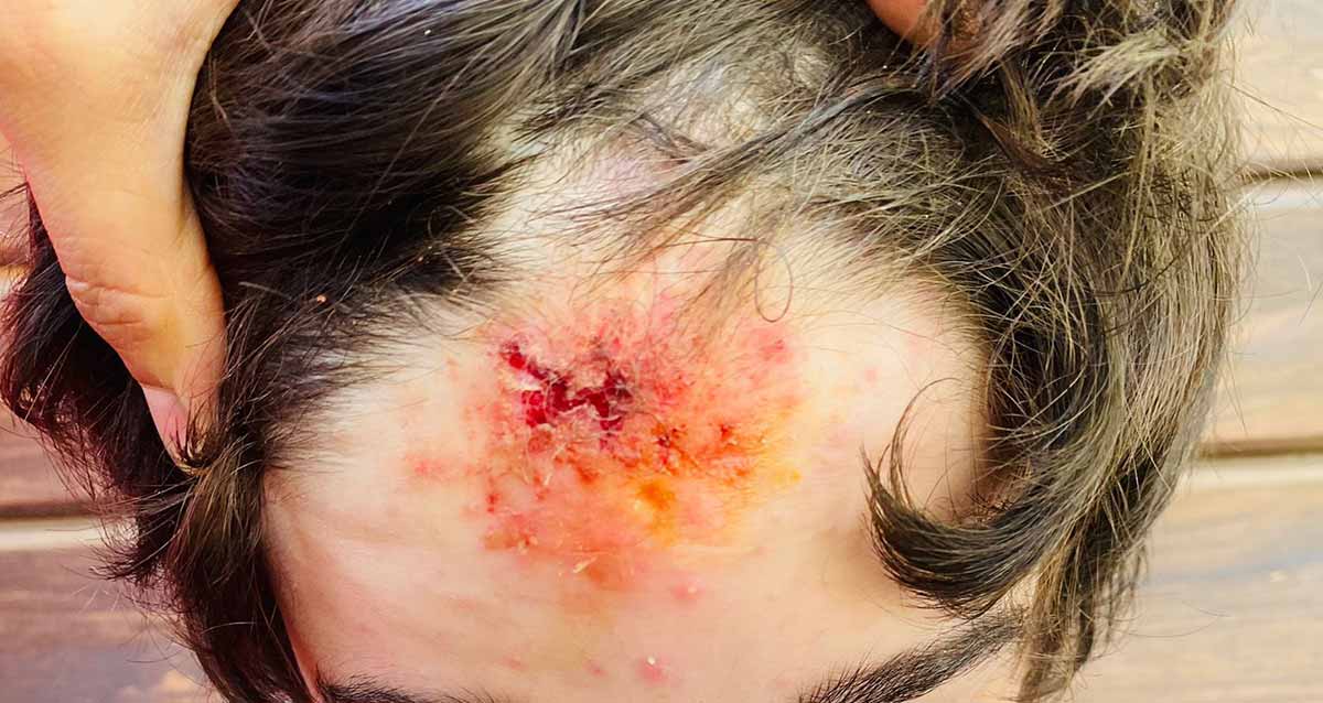 ראשו הפצוע של סער. צילום: פרטי