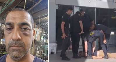 שלומי שבתאי בכניסה לביה"ח בני ציון ועם החבלה בעיניים. צילום: לפי סעיף 27 א