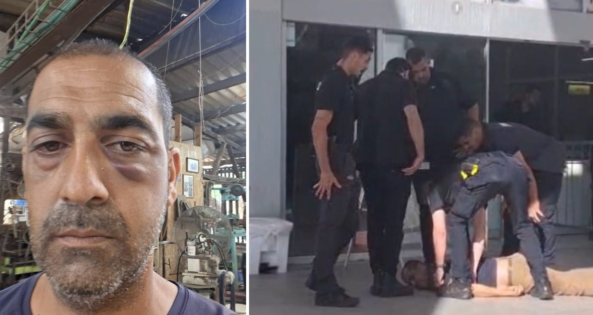שלומי שבתאי בכניסה לביה"ח בני ציון ועם החבלה בעיניים. צילום: לפי סעיף 27 א